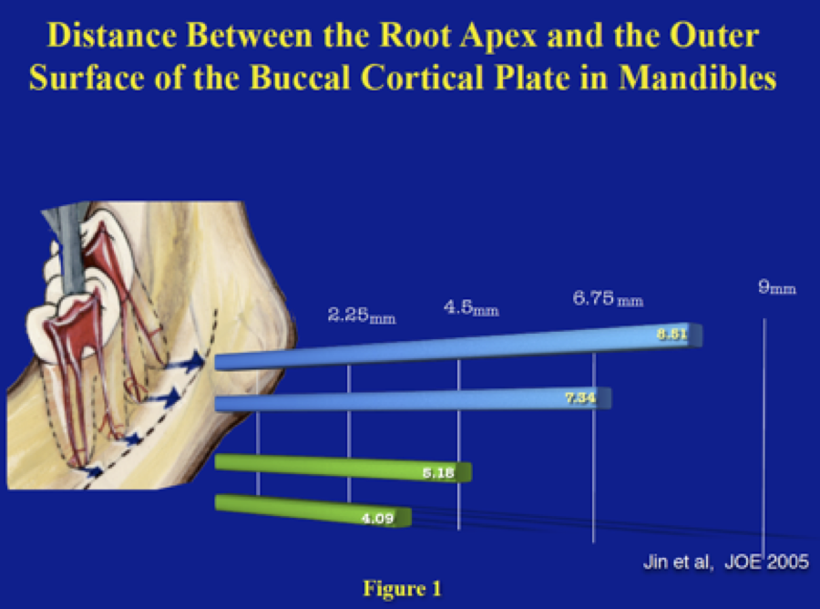 Intentional Replantation | Next Level Endodontics